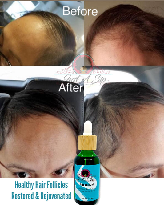 What Is The Connection Between Diet And Hair Loss?