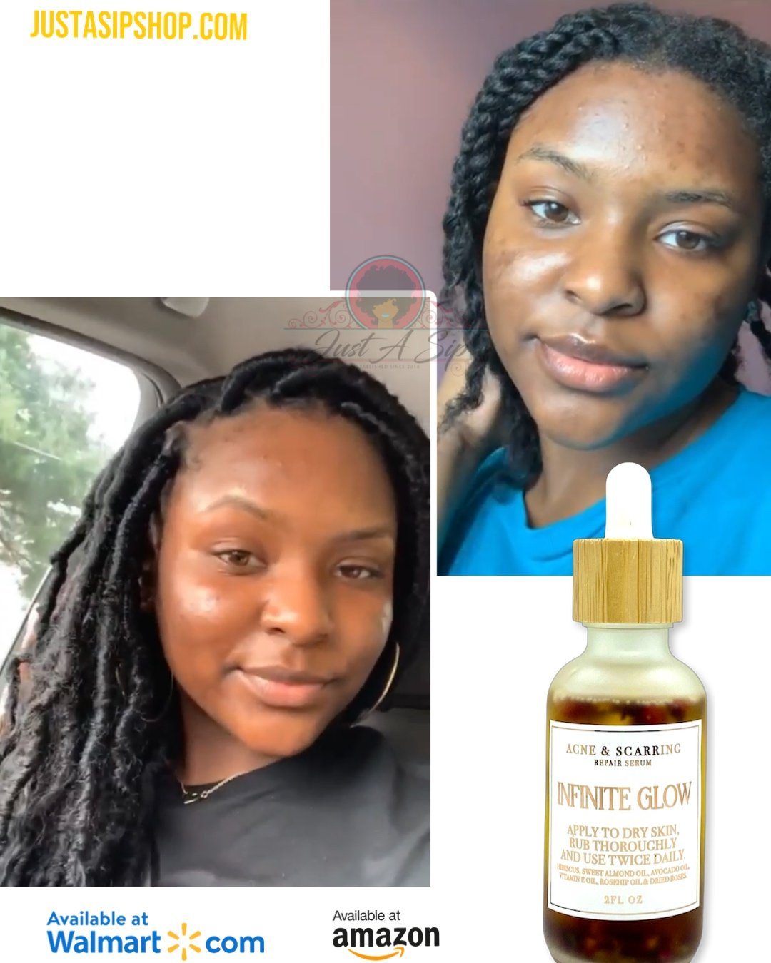 Infinite Glow Acne & Scarring Repair Serum